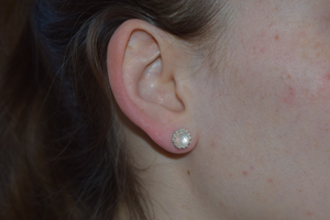 Zilveren oorsteker met een facet geslepen edelsteen en zilveren bolletjes. - rond